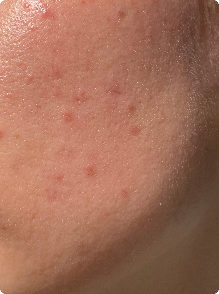 VA Skin Glow 32 Rectangle 102 1