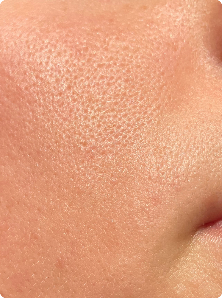 VA Skin Glow 34 Rectangle 102 2