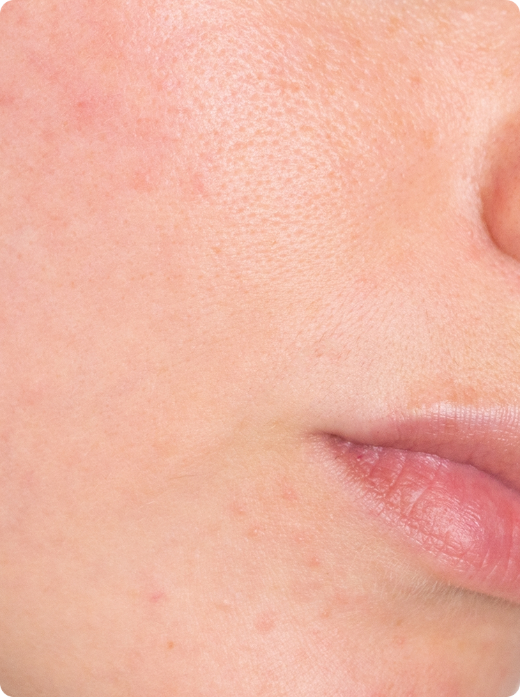 VA Skin Glow 30 Rectangle 102