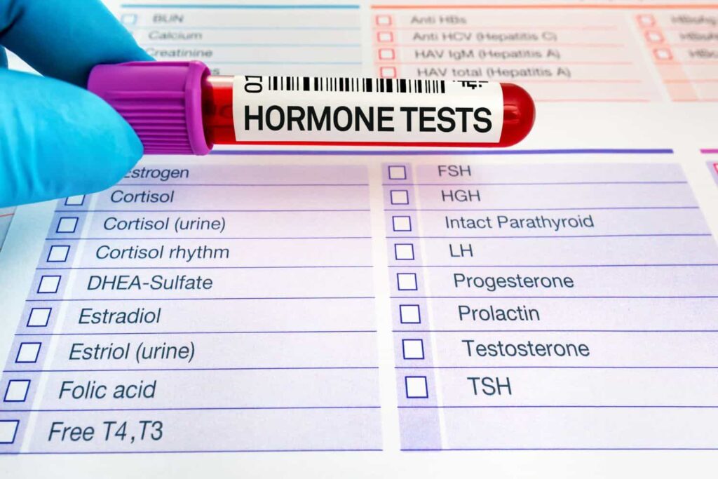 Hormonal Profile Test